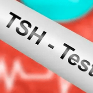 آزمایش خون TSH