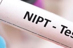 آزمایش NIPT