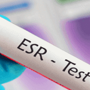 تست esr در آزمایش خون