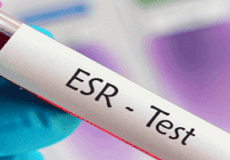 تست esr در آزمایش خون