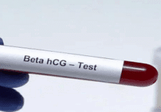 تفسیر آزمایش Beta hCG