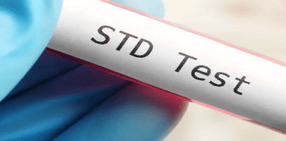 تفسیر آزمایش STD با PCR