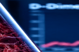 آزمایش D-Dimer چیست