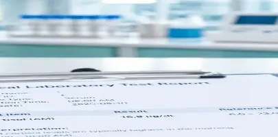 آزمایش کورتیزول صبحگاهی؛ نمونه خون و گزارش آزمایش در محیط آزمایشگاهی