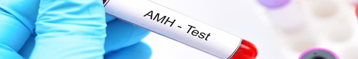 آزمایش AMH