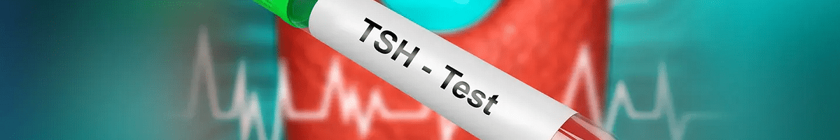 آزمایش خون TSH
