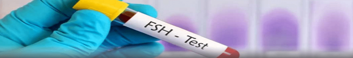 تفسیر آزمایش FSH